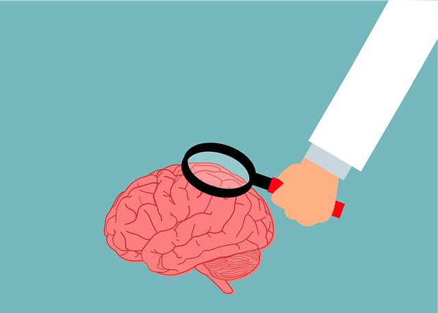 cerveau – pixabay