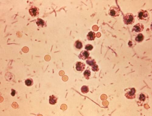 Shigellose : une maladie mortelle qui se propage en France