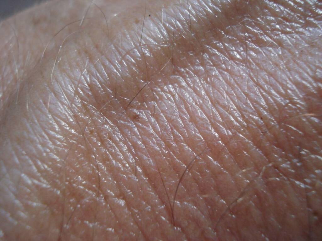 Cancers de la peau 4 vérités à connaître pour bien se protéger